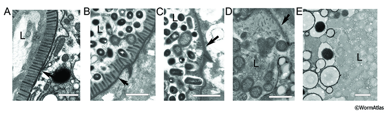 AIntFIG 6: Degradation of intestinal microvilli during aging. 